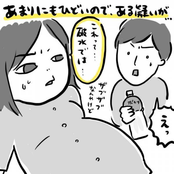 「ザブザブなんだけど…」陣痛中、精神的に私を追い詰めたもの #出産体験談 1