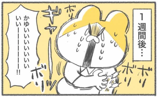 「かゆいいいいいッ！！」地獄の日々がスタート #キヨの妊娠記録28