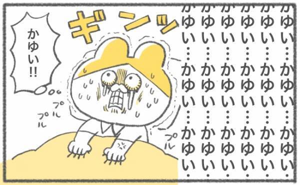 「かゆいいいいいッ！！」地獄の日々がスタート #キヨの妊娠記録28