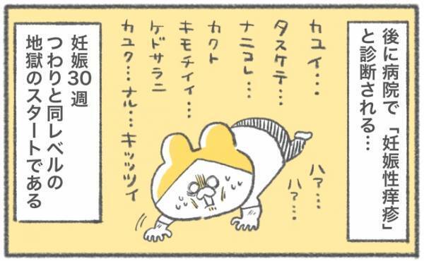 「かゆいいいいいッ！！」地獄の日々がスタート #キヨの妊娠記録28