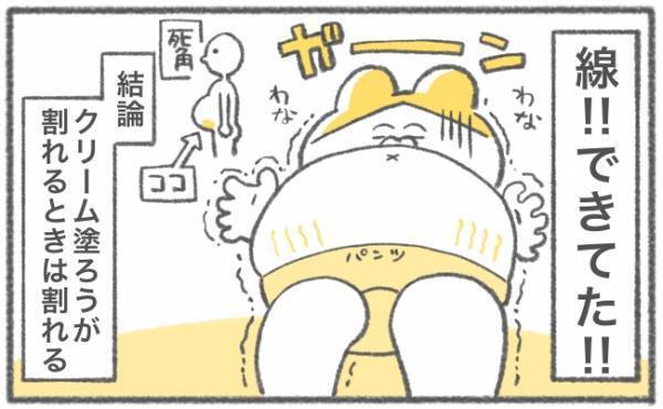 妊娠線できてないのよ！とドヤッたものの… #キヨの妊娠記録27