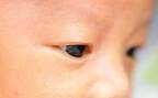 顔や白目の色が気になる…。赤ちゃんの黄疸について【助産師に相談】