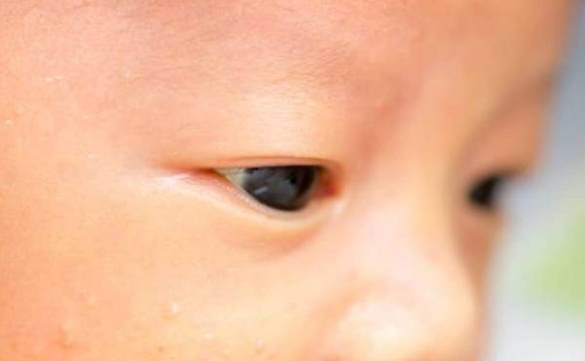 顔や白目の色が気になる 赤ちゃんの黄疸について 助産師に相談 年1月16日 ウーマンエキサイト 1 2