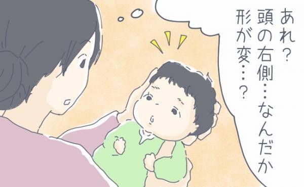 元に戻るの？ 吸引分娩で赤ちゃんの頭の形がいびつに…【体験談】