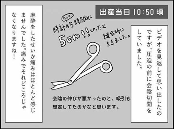 「ついに会陰切開…！そんなに切ったんだ～？」　#出産レポ23