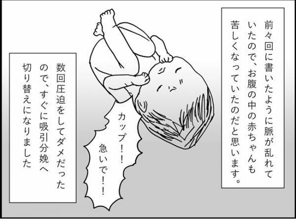 「ついに会陰切開…！そんなに切ったんだ～？」　#出産レポ23