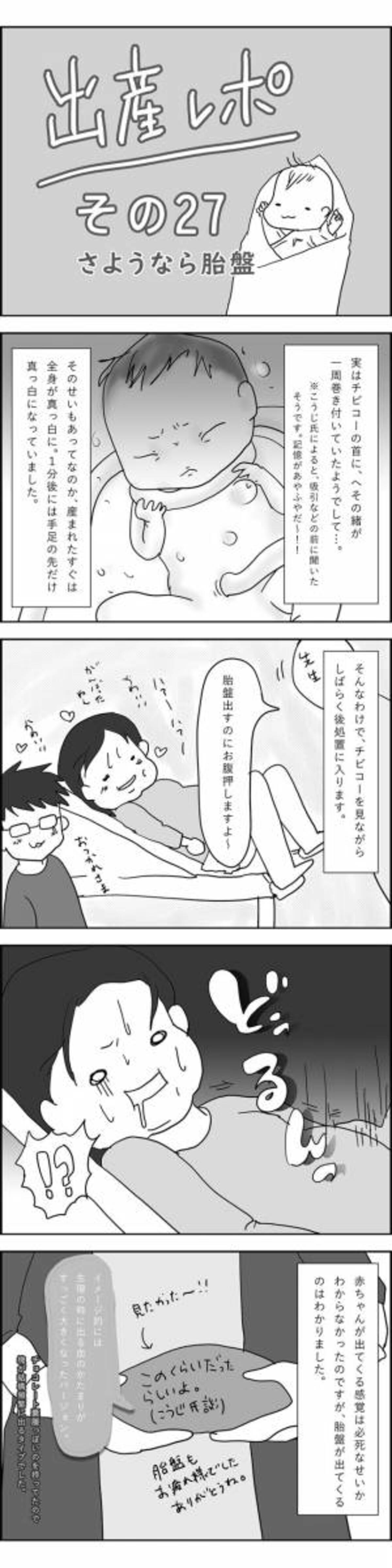 生まれたてのとき 全身真っ白 そのワケは 出産レポ27 年3月23日 ウーマンエキサイト