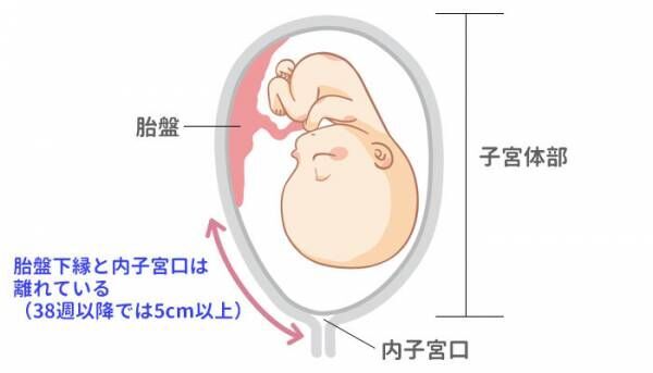 正常な胎盤位置のイメージ