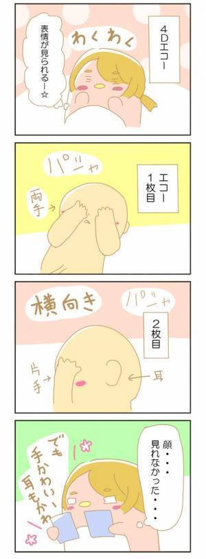 ウソでしょ？楽しみにしていた4Dエコー【赤ちゃんがやってくる！25】