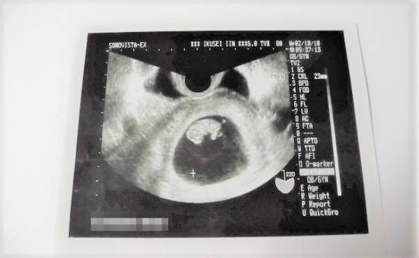 何これ 不思議な胎動 その正体は だった 体験談 年4月10日 ウーマンエキサイト 1 2