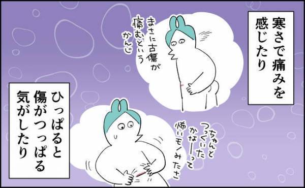 帝王切開の傷をどう思うか？問題【んぎぃちゃんカレンダー141】