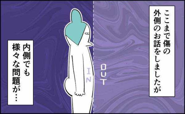 ぎゃー痛い！激痛が走る場所はなんと…【んぎぃちゃんカレンダー142】