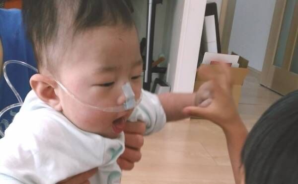 肺が片方しかない赤ちゃんの生活 人工呼吸器から酸素吸入器に切り替えて 年6月21日 ウーマンエキサイト 1 2