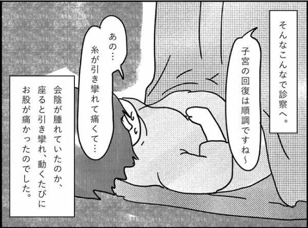 「お股が痛い！！」怖いけど…ついに会陰抜糸！ #産後レポ12