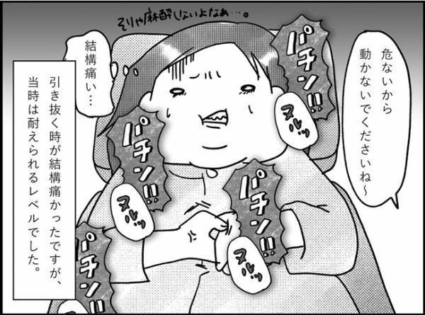 「お股が痛い！！」怖いけど…ついに会陰抜糸！ #産後レポ12