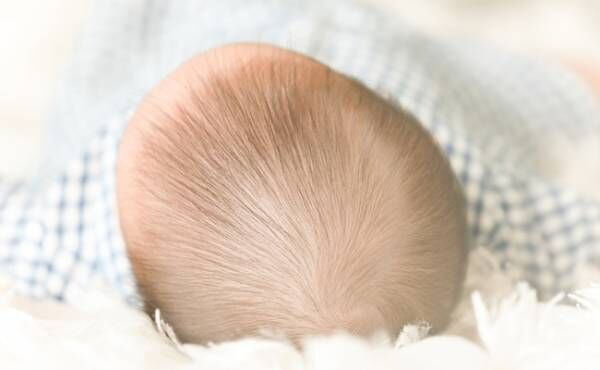 赤ちゃんの頭の変形のイメージ