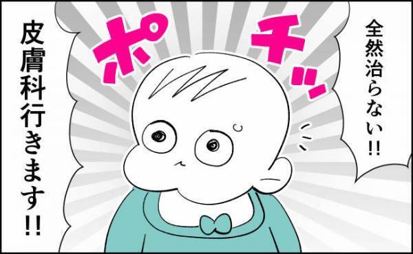 医師の言葉を信じ、2カ月薬を塗布！果してその結果は…！？