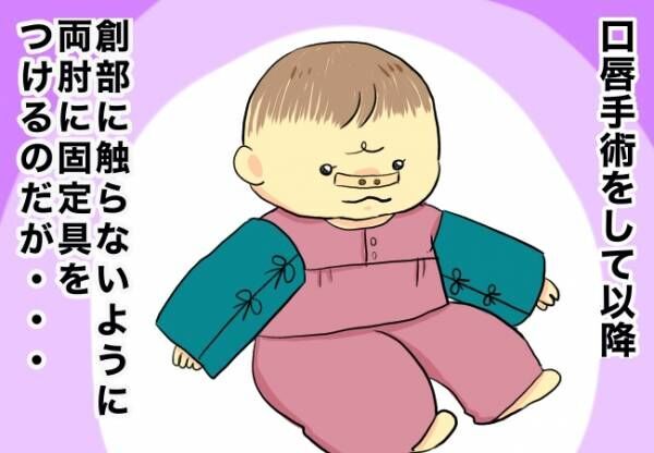抑制帯を固定する方法を模索 口唇口蓋裂ちゃん 育ててます98 年8月4日 ウーマンエキサイト 1 2