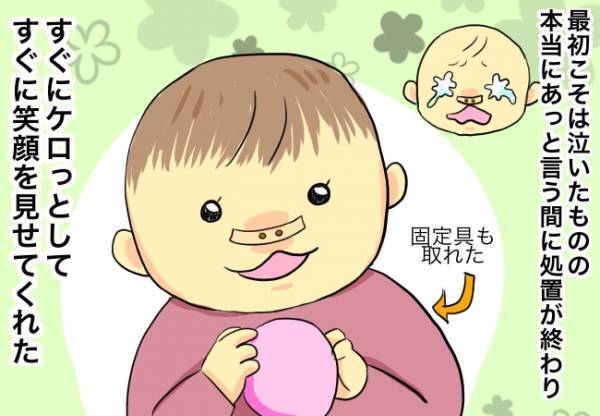 抜糸手術終了！退院が決定！【口唇口蓋裂ちゃん、育ててます100】