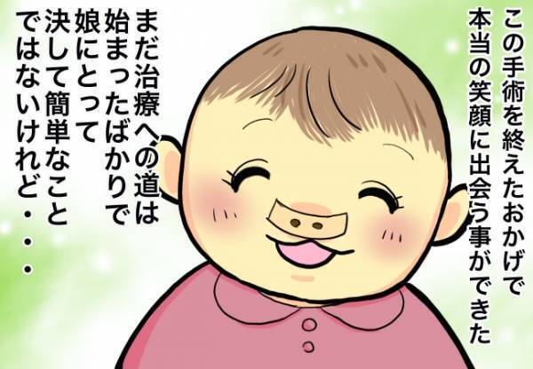 無事退院！口唇裂手術が終了【口唇口蓋裂ちゃん、育ててます101】