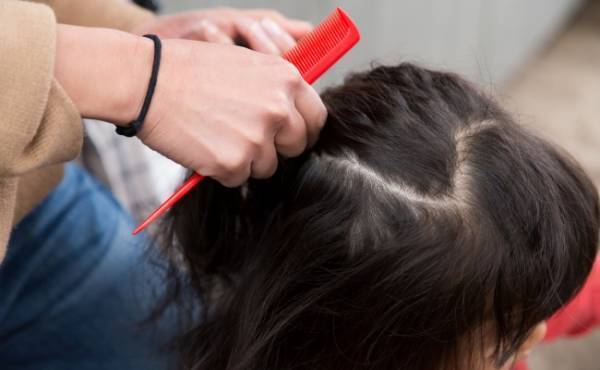 意外と多い！？ 0歳～幼児期に感染しやすいアタマジラミに注意！！