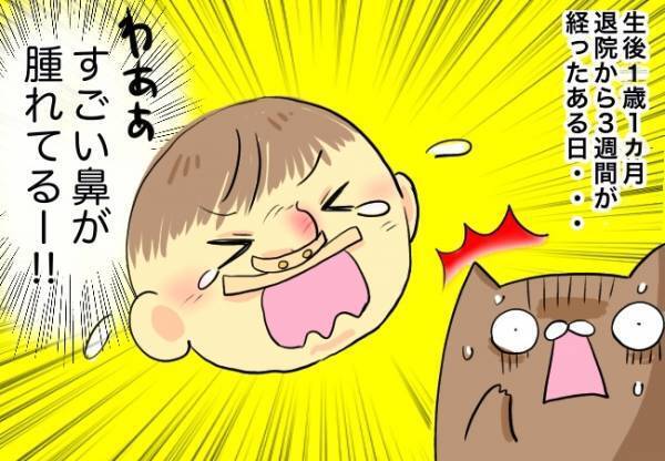 退院から3週間後、トラブル発生【口唇口蓋裂ちゃん、育ててます105】