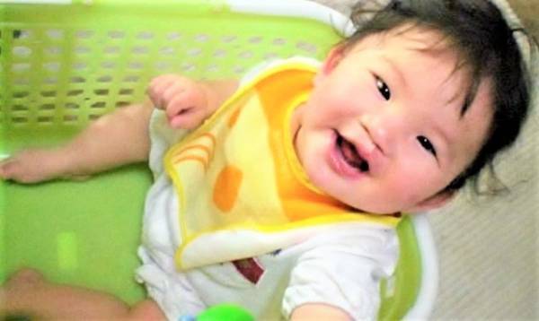 1歳で…口唇口蓋裂の治療ってどんなことをするの！？【2回目の手術編】