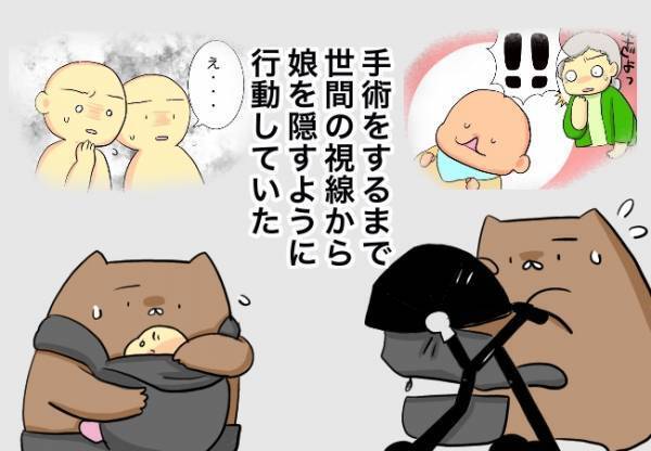 手術後に感じた周りの反応の変化【口唇口蓋裂ちゃん、育ててます107】