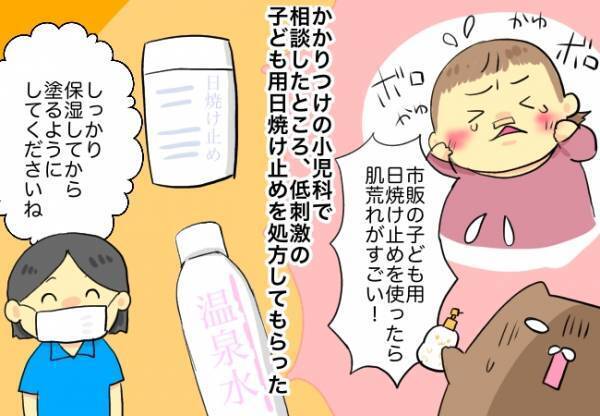 術後の生活で特に気を付けたこと【口唇口蓋裂ちゃん、育ててます108】