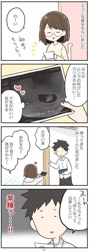 えええ！？辛辣すぎだろ！ 初めてのエコー写真を見た旦那氏の反応