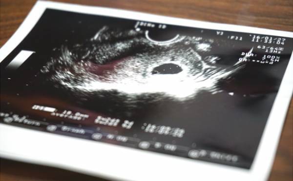 結局、赤ちゃんは授かりもの？妊活終了のお知らせは突然でした　#不妊治療