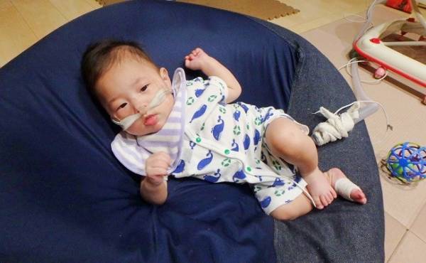 おさがりはいっぱいあるのに！ 医療的ケア児の息子が着られなかった服