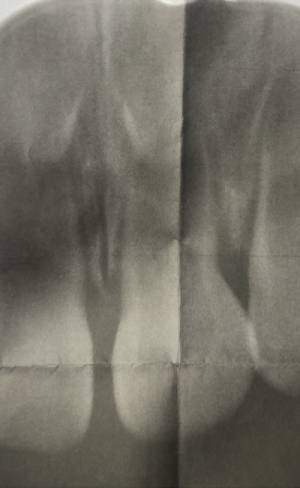 生後10カ月、ベッドから落ちて血だらけに。レントゲンの結果…！？