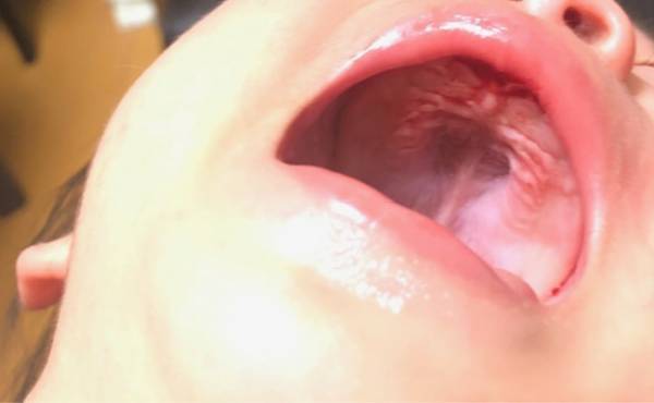 生後10カ月、ベッドから落ちて血だらけに。レントゲンの結果…！？