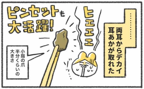 「デ…デカイ！」大きな耳あかとれた！娘の耳掃除に超便利だったアイテム