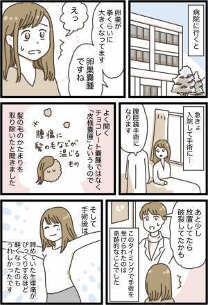「生理痛がひどくて……助かった！？」30代で卵巣嚢腫が判明→手術