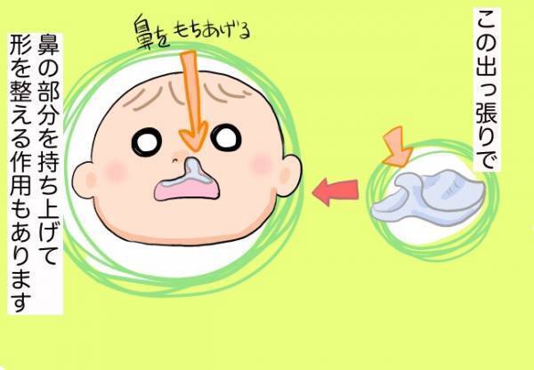 口蓋裂の子どもの必需品、完成！【口唇口蓋裂ちゃん、育ててます39】