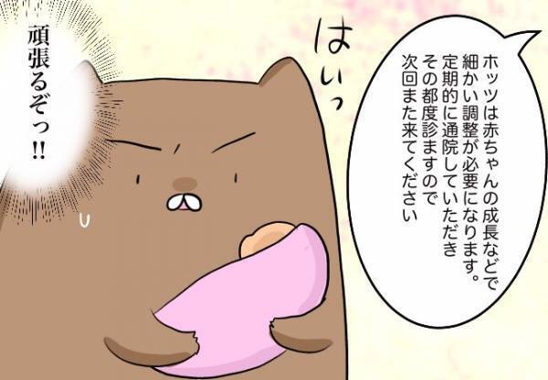 口蓋裂の子どもの必需品、完成！【口唇口蓋裂ちゃん、育ててます39】