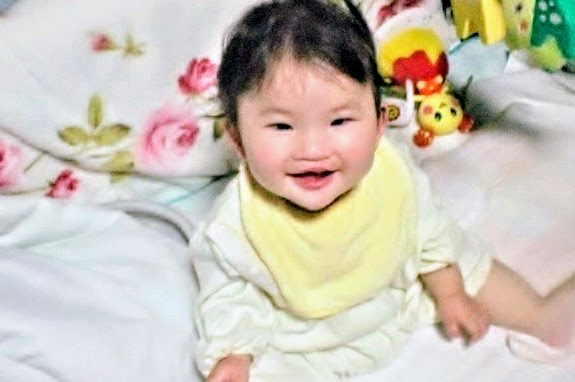 口唇口蓋裂って何！？治るの…？先天異常を持った娘の症状と治療【後編】