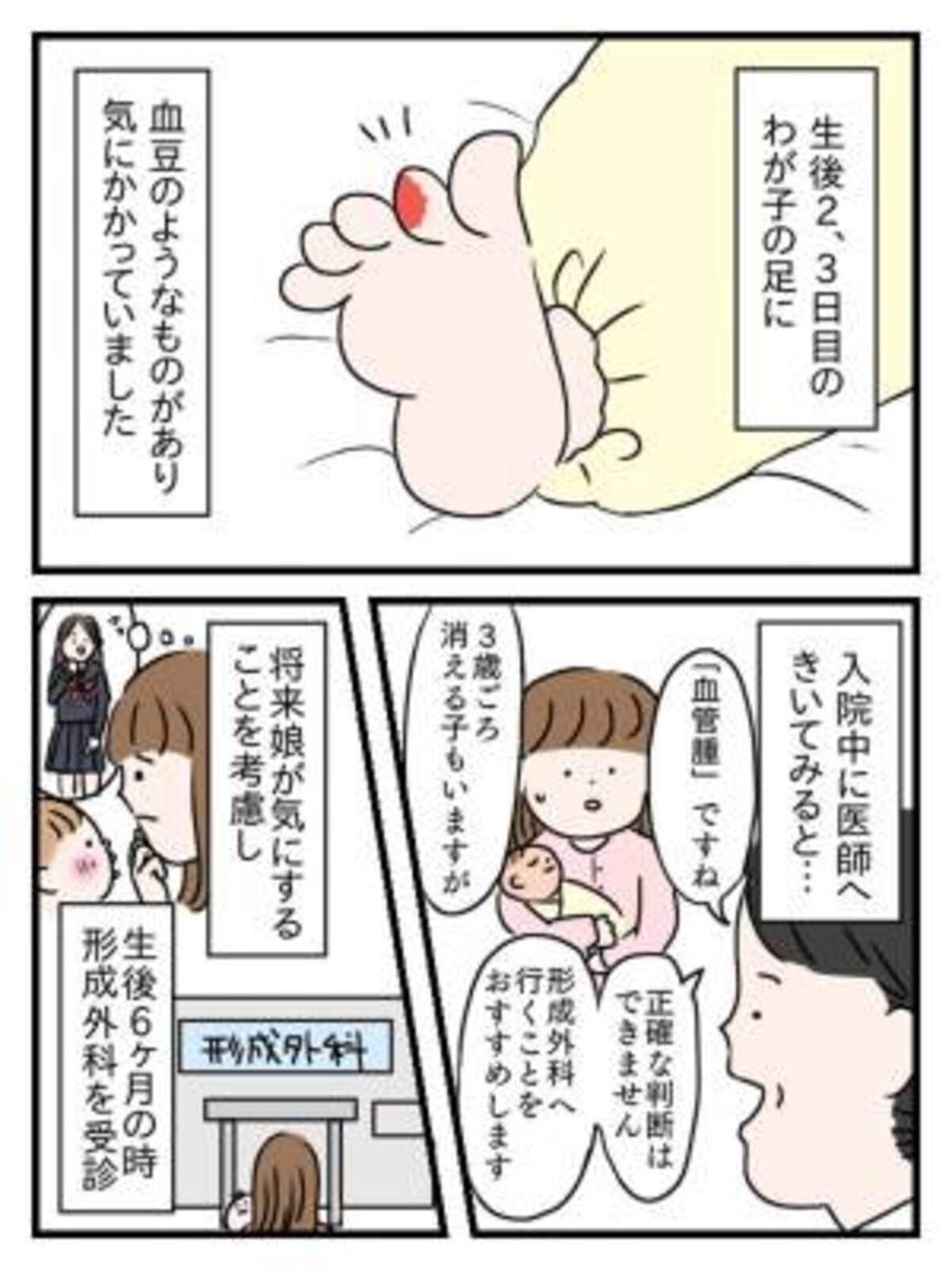 生後すぐの娘の右足に血豆のような腫れが 治療を決意し実行した結果 年3月4日 ウーマンエキサイト 1 2