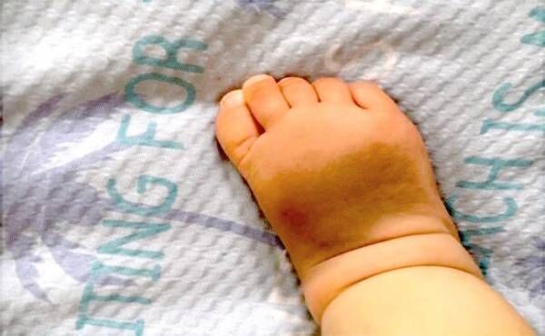 赤ちゃんの蒙古斑が足に あざを周りに指摘されると不安になってしまい 19年12月23日 ウーマンエキサイト 1 2