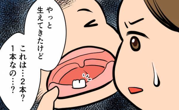 やっと生えた歯が…息子の歯科検診でまさかの診断結果に驚き！