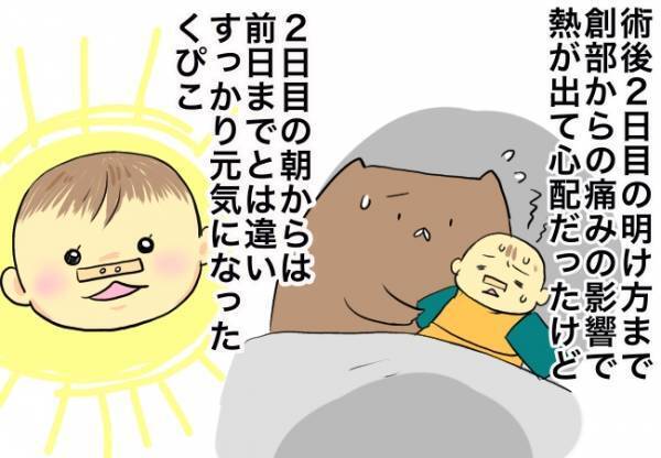 術後2日後、1番嬉しかったこと！【口唇口蓋裂ちゃん、育ててます96】