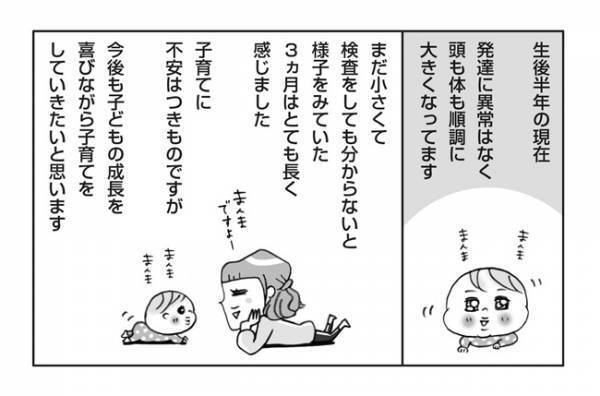 「え、頭の大泉門が閉鎖？」1カ月健診で軽度筋緊張亢進疑いと診断されて