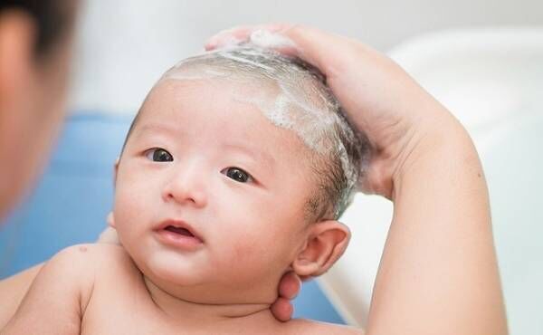 乳児脂漏性湿疹の赤ちゃんのイメージ