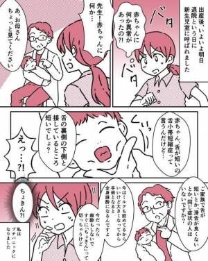 ちょきんって切るけど って大丈夫なの 息子の舌が短いと指摘され 年12月26日 ウーマンエキサイト 1 2 ちょきんって切るけど って大丈夫なの 息子の舌が短いと指摘され 年12月26日 ウーマンエキサイト 1 2