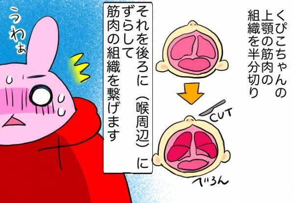 手術内容に驚愕！切る？縫う！？痛々しい手術内容にパパママ絶句…！