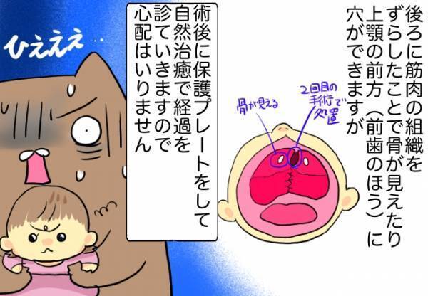 手術内容に驚愕！切る？縫う！？痛々しい手術内容にパパママ絶句…！