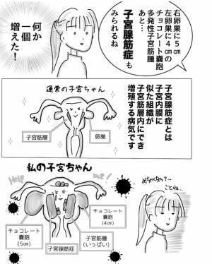 検査の結果「ん？なんか1個増えた！」懐も痛い…【子宮内膜症入院＃4】
