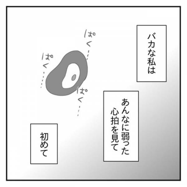 俺らの子だもん 医師の告知に号泣 私を救った夫の言葉とは 流産のはなし 7 21年4月26日 ウーマンエキサイト